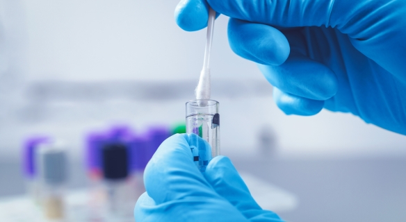 Qu’est-ce qu’un test génétique ?